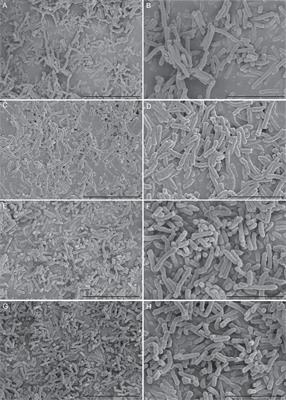 Biofilm formation and antibiotic sensitivity in Elizabethkingia anophelis